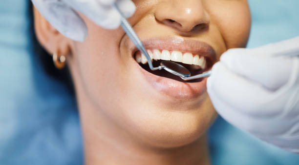 Best Walk-In Emergency Dental Services in Divernon, IL