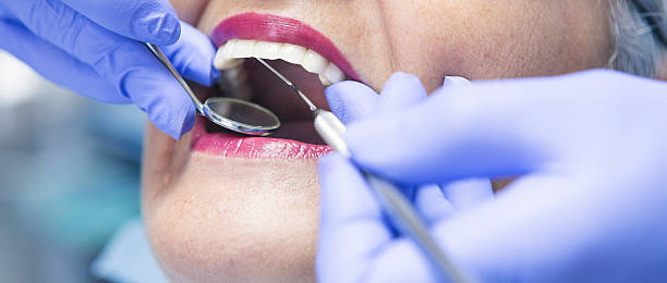 Best Emergency Wisdom Tooth Extraction in Divernon, IL
